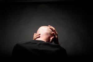 En Colombia tres de cada 7 hombres se realizan implantes capilares.