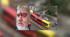 Un conductor de TransMilenio resultó herido tras recibir un botellazo por parte de una mujer.