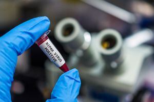 Muestra de sangre positiva para el virus Nipah