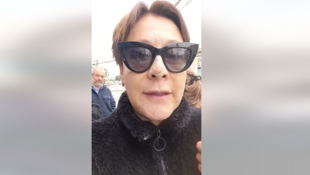 Así luce el rostro de Alina Lozano luego de entrar al quirófano