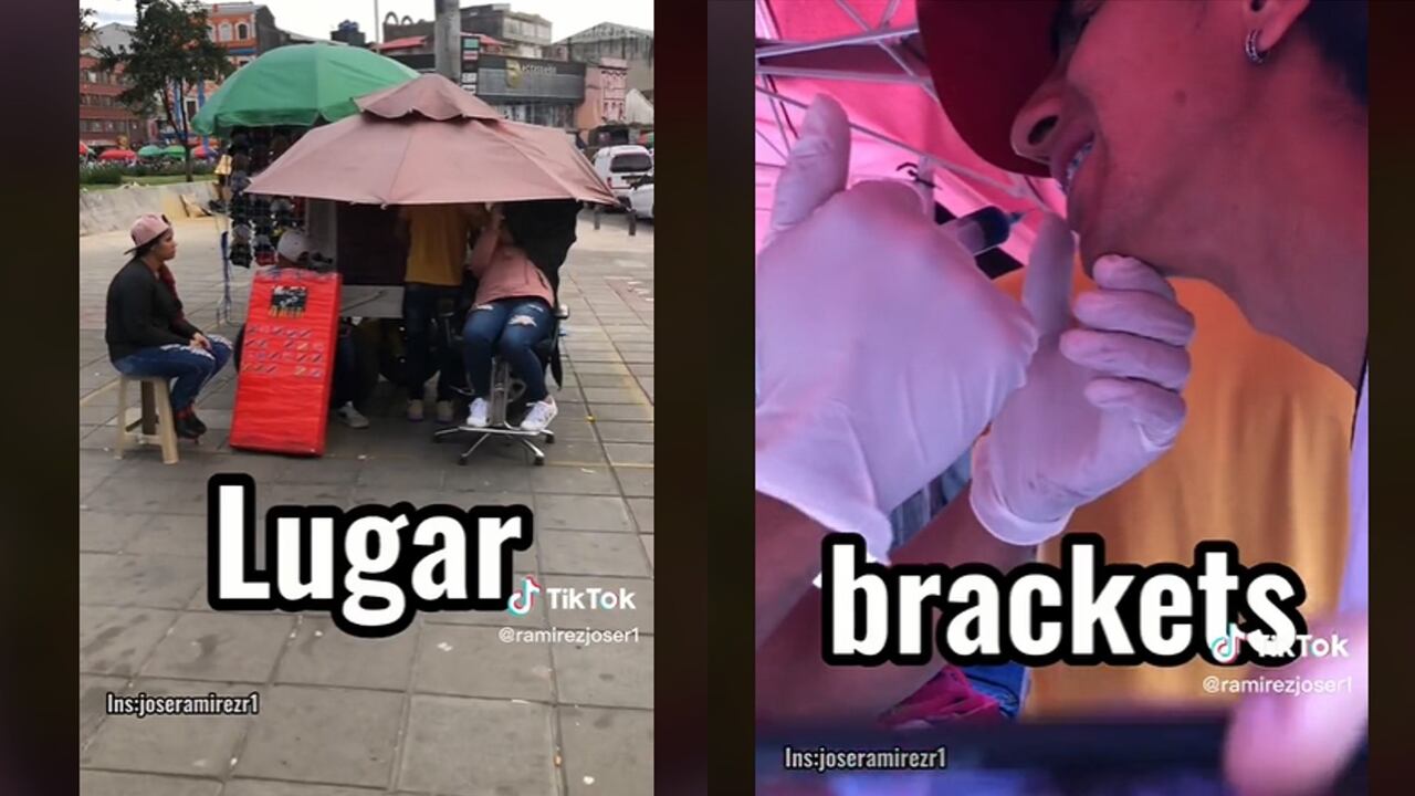 Brackets de 100 mil: tiktoker mostró cómo es la experiencia en el centro, en tiempo récord