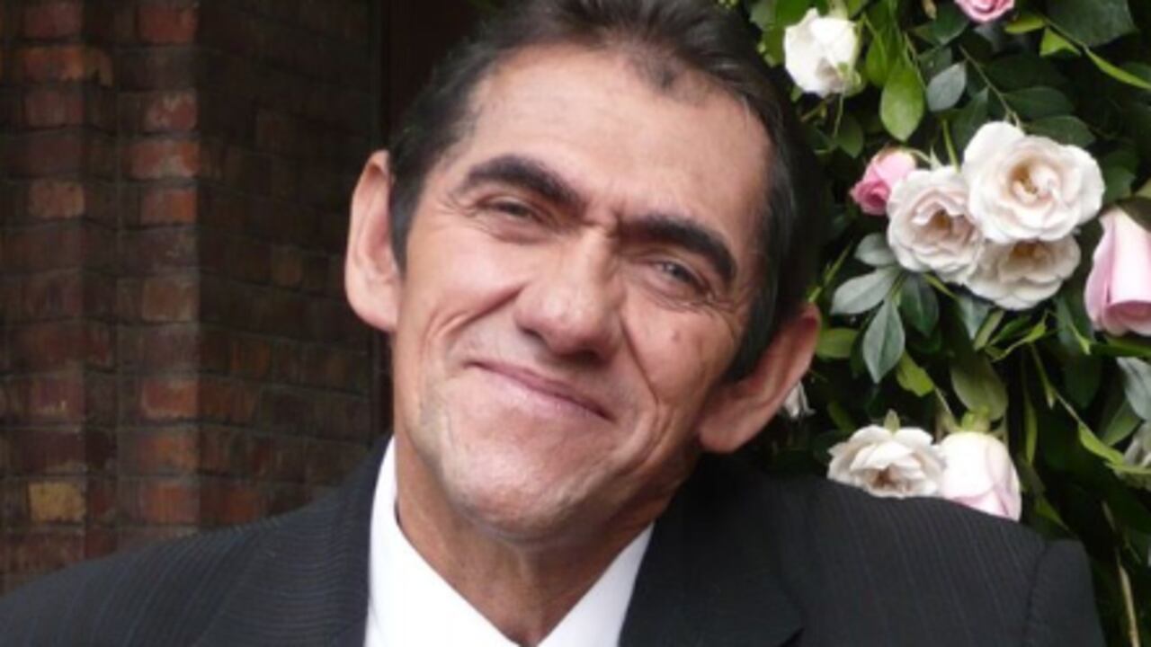 Mandíbula enfermedad