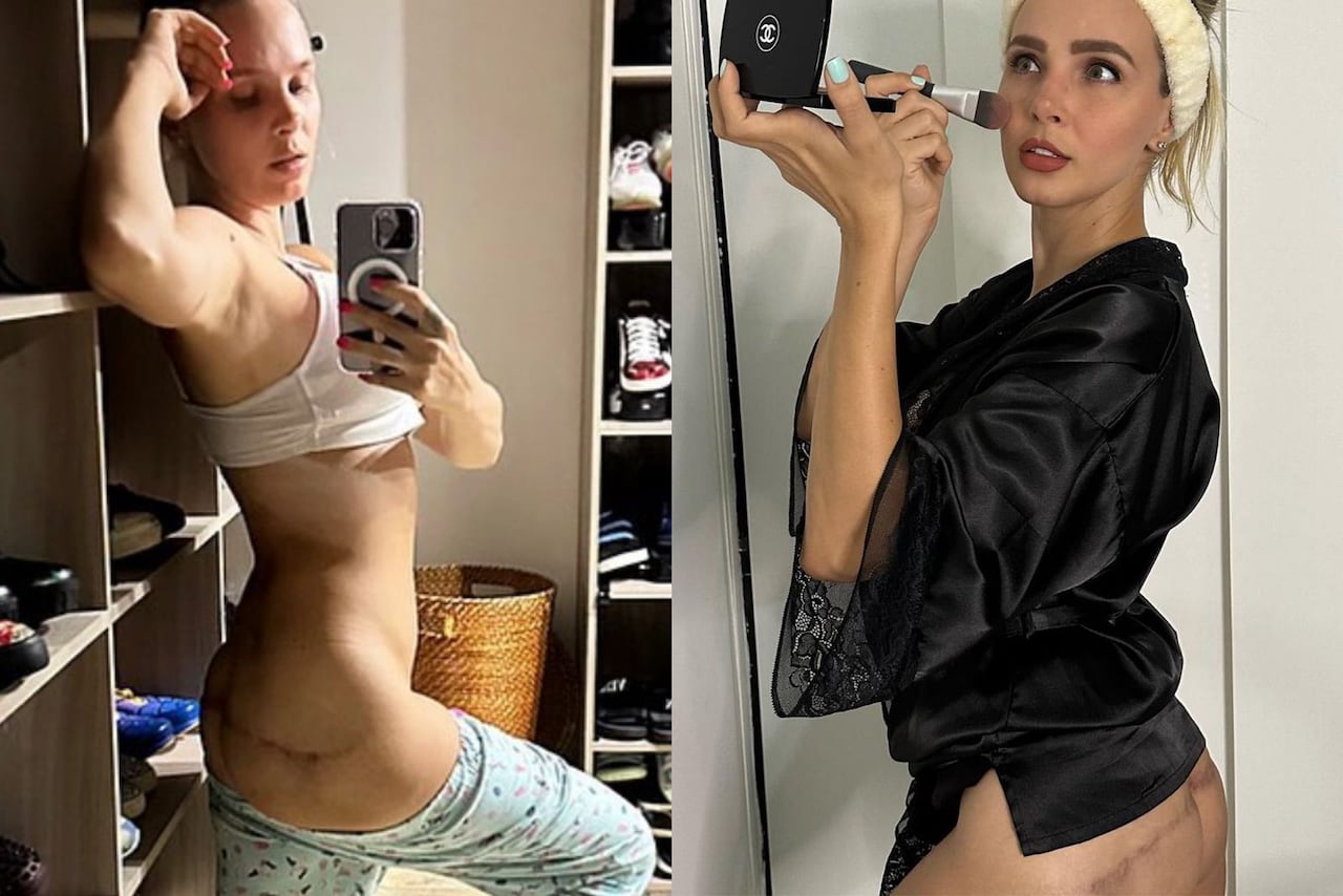 La modelo y empresaria Elizabeth Loaiza ha compartido en sus redes todo el proceso que ha vivido desde que le encontraron biopolímeros en su cuerpo.
