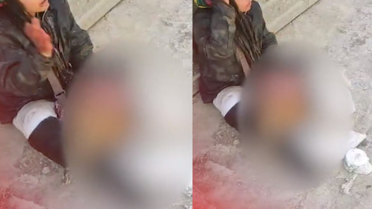 Por lo pronto se desconoce si el canino era callejero o si pertenecía a algún habitante de la zona.