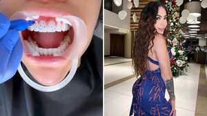 La empresaria e influencer incrustó 80 diamantes en sus dientes.