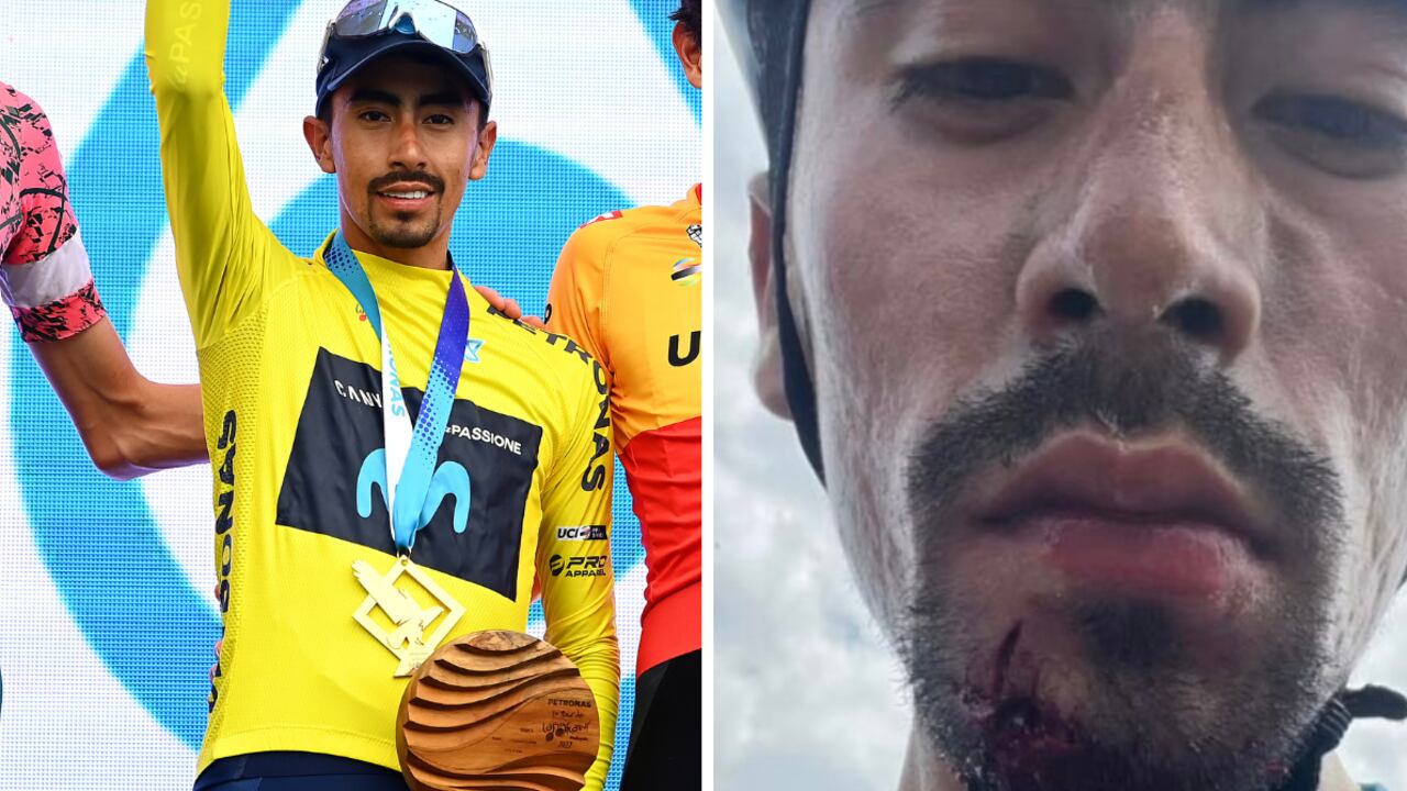 Iván Ramiro Sosa tras el accidente.