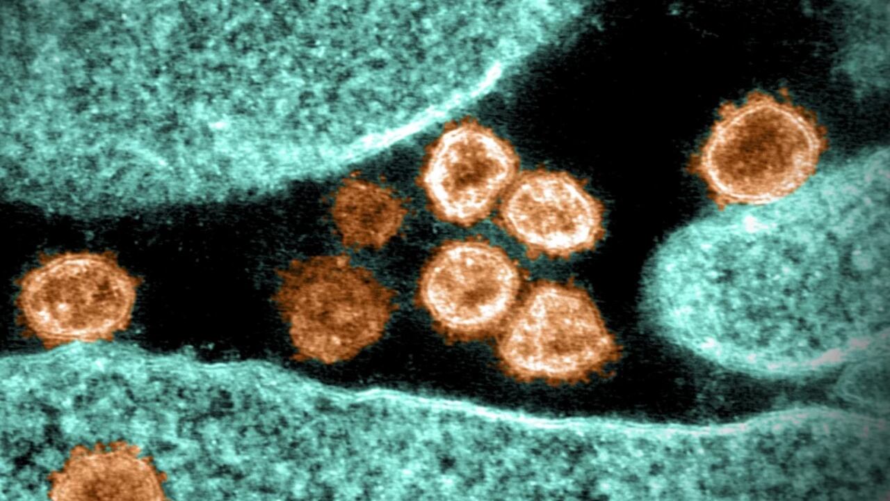 Variante iota, advierten cómo esta nueva cepa del coronavirus se expande con mayor rapidez