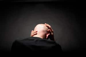 En Colombia tres de cada 7 hombres se realizan implantes capilares.