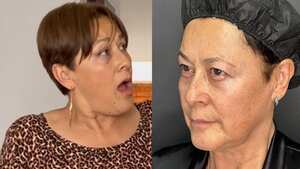 La actriz dejó ver los cambios después de sus retoques.