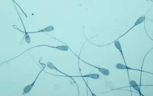 Científicos estudian el efecto de la radiación de los teléfonos en los espermatozoides.