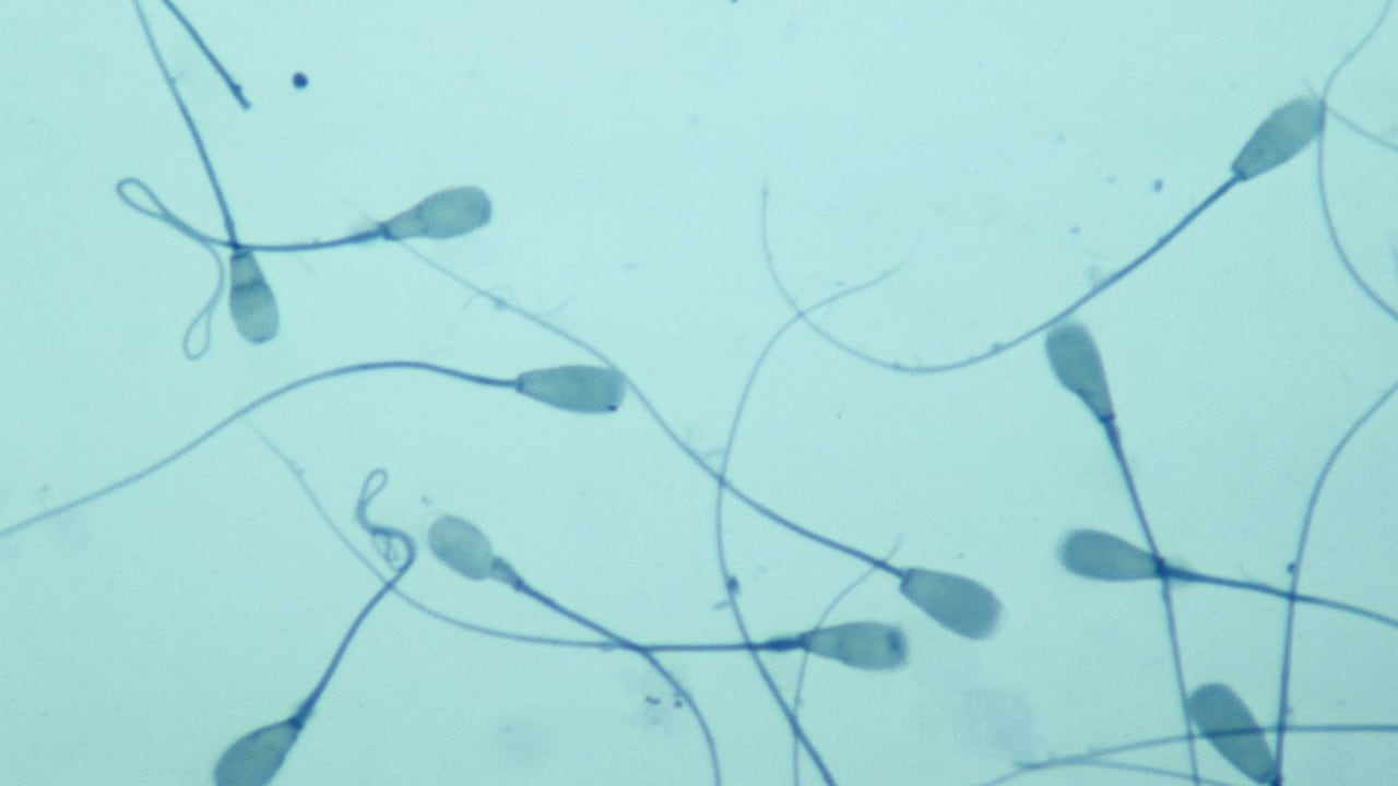 Científicos estudian el efecto de la radiación de los teléfonos en los espermatozoides.