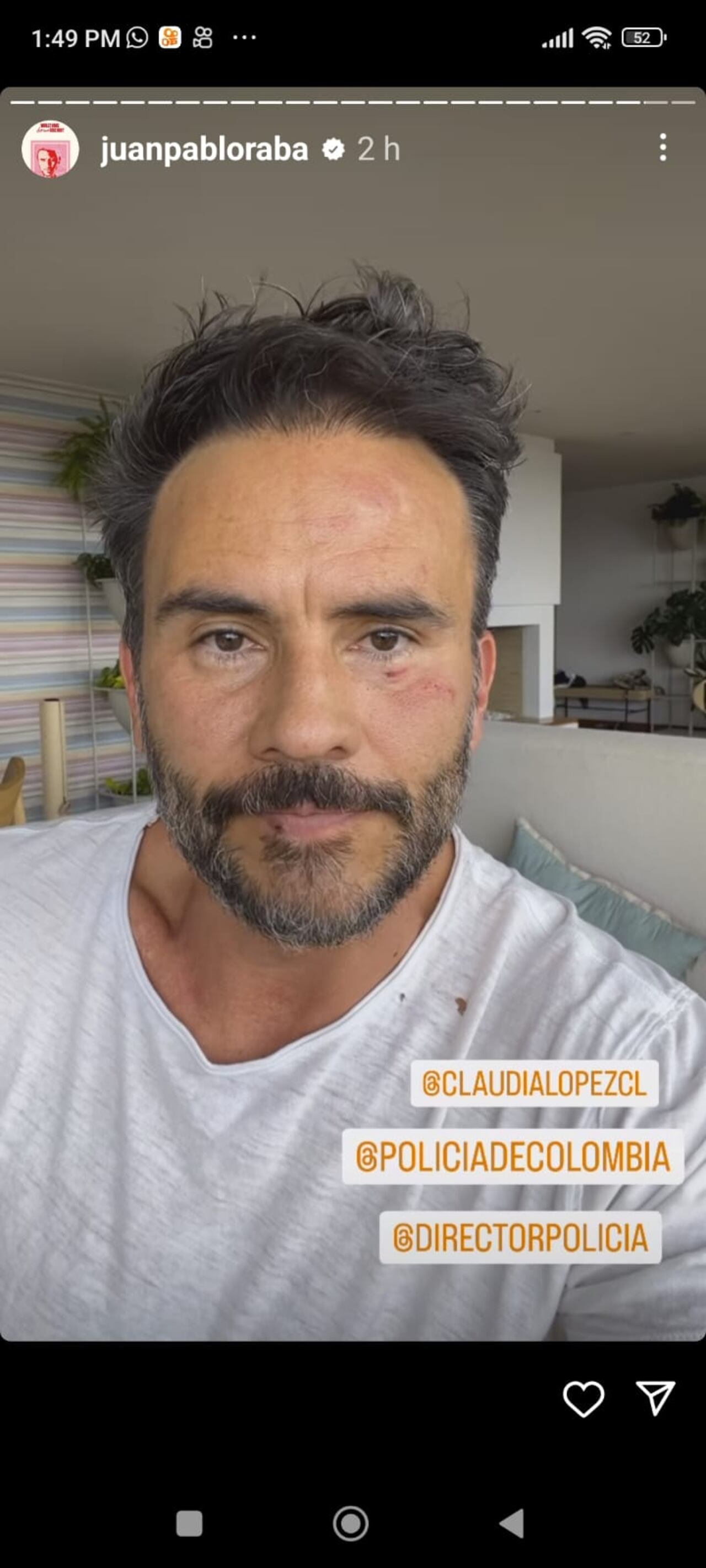 Juan Pablo Rada golpeado