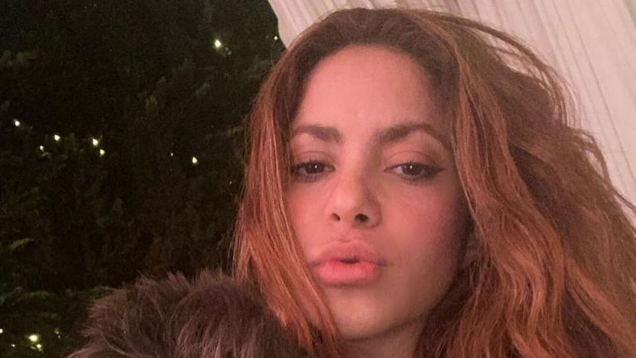 Cuestionan a Shakira por aparentes retoques en la cara