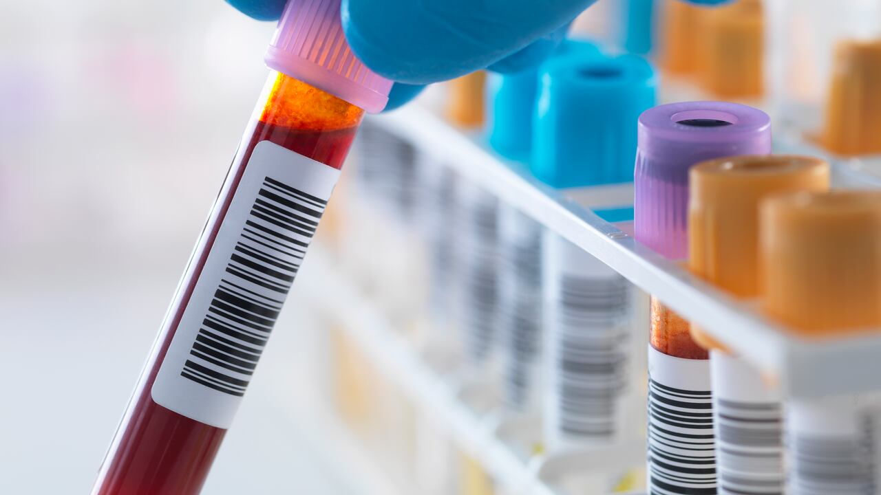 El VIH no es lo mismo que el SIDA.